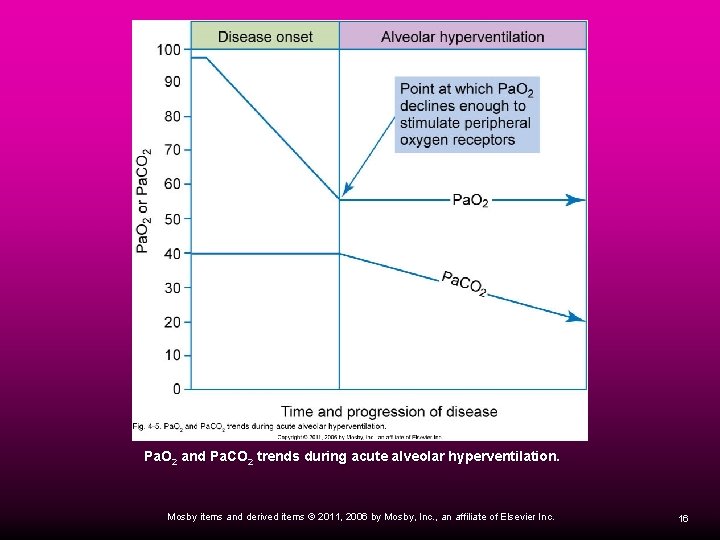 Pa. O 2 and Pa. CO 2 trends during acute alveolar hyperventilation. Mosby items