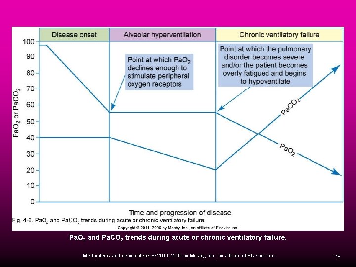 Pa. O 2 and Pa. CO 2 trends during acute or chronic ventilatory failure.