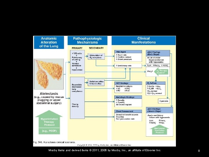 Mosby items and derived items © 2011, 2006 by Mosby, Inc. , an affiliate
