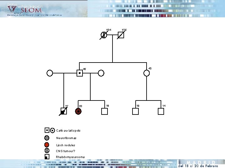 † 34 † 75 43 45 † 7 20 Café-au-lait spots Neurofibromas Lisch nodules