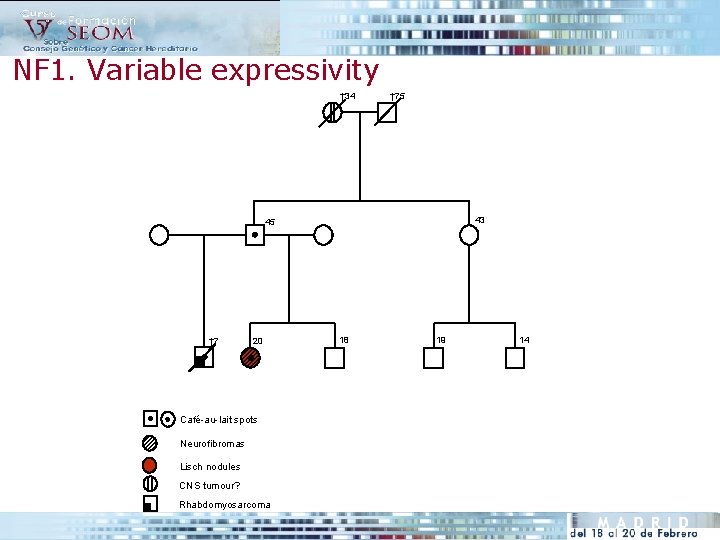 NF 1. Variable expressivity † 34 † 75 43 45 † 7 20 Café-au-lait