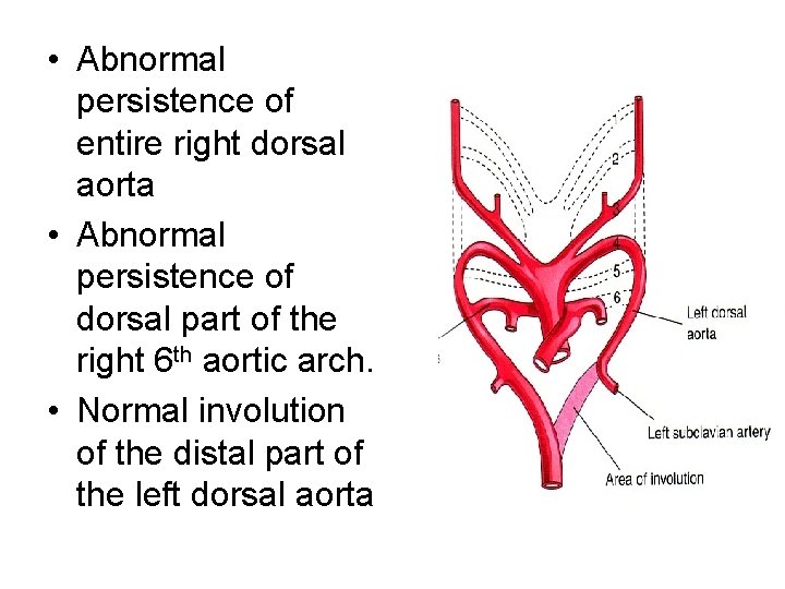  • Abnormal persistence of entire right dorsal aorta • Abnormal persistence of dorsal