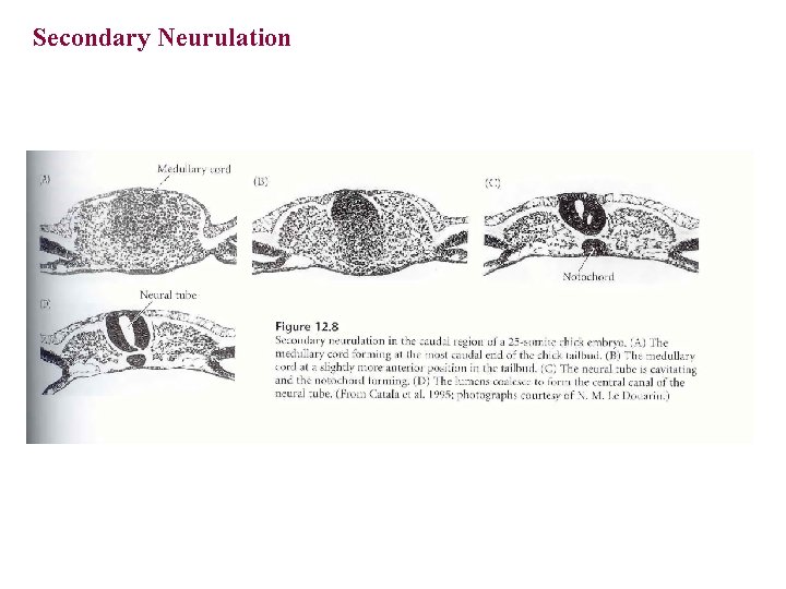 Secondary Neurulation Secondary Neurulation
