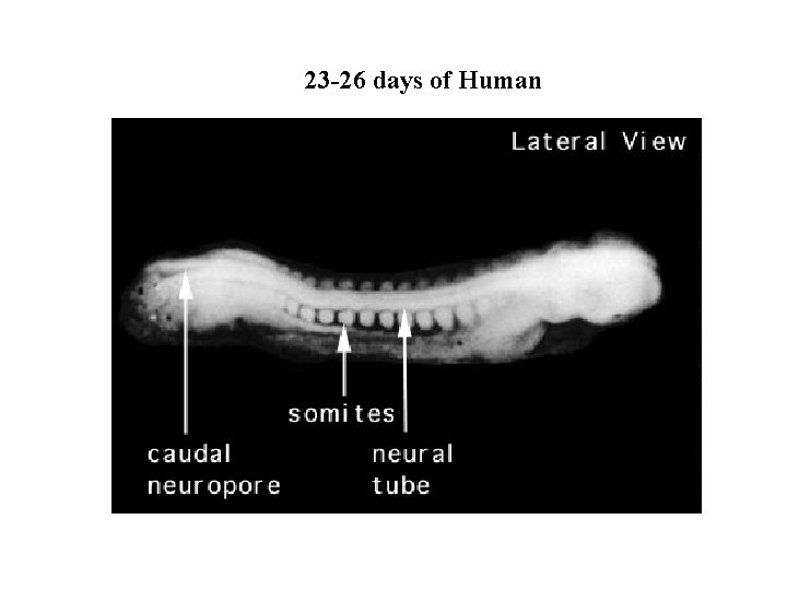 23 -26 days of Human 23 -26 days of Human