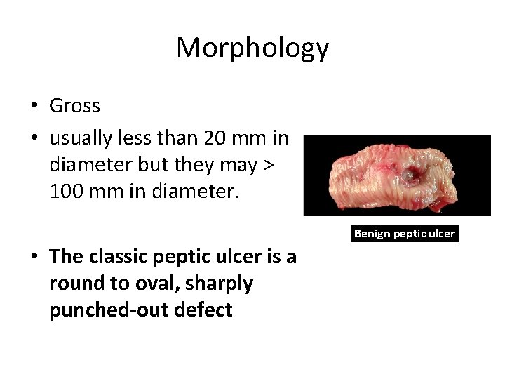 Morphology • Gross • usually less than 20 mm in diameter but they may