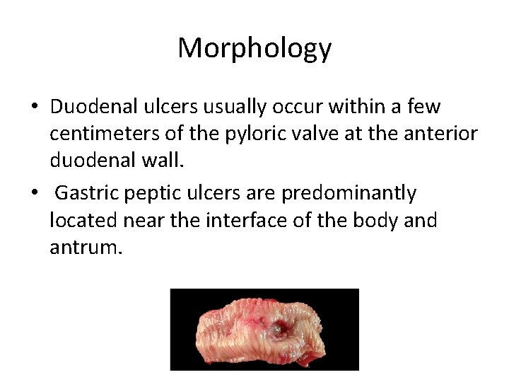 Morphology • Duodenal ulcers usually occur within a few centimeters of the pyloric valve