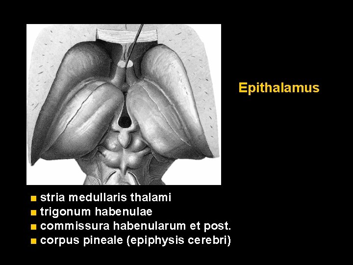 Epithalamus ■ stria medullaris thalami ■ trigonum habenulae ■ commissura habenularum et post. ■