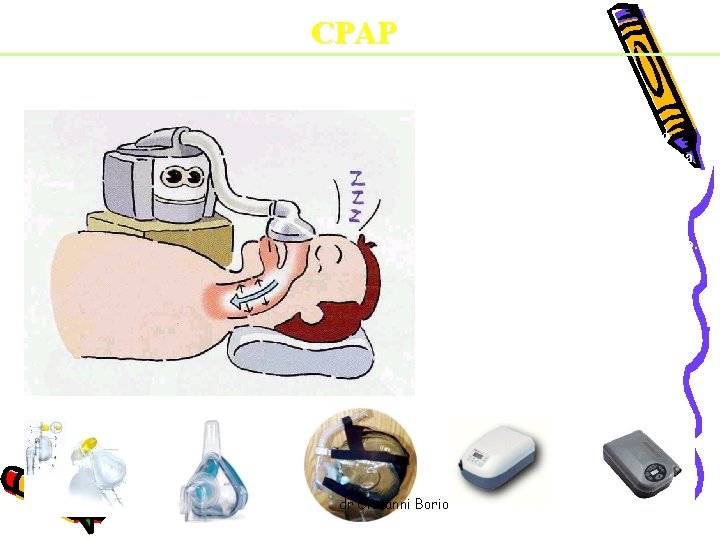 CPAP Continous Positive Airway Pressure Misura molto efficace in quanto producendo una pressione continua