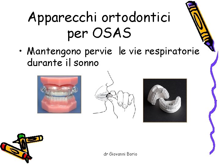 Apparecchi ortodontici per OSAS • Mantengono pervie le vie respiratorie durante il sonno dr