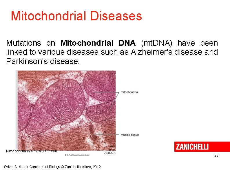 Mitochondrial Diseases Mutations on Mitochondrial DNA (mt. DNA) have been linked to various diseases