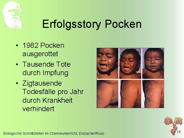 Erfolgsstory Pocken • 1982 Pocken ausgerottet • Tausende Tote durch Impfung • Zigtausende Todesfälle