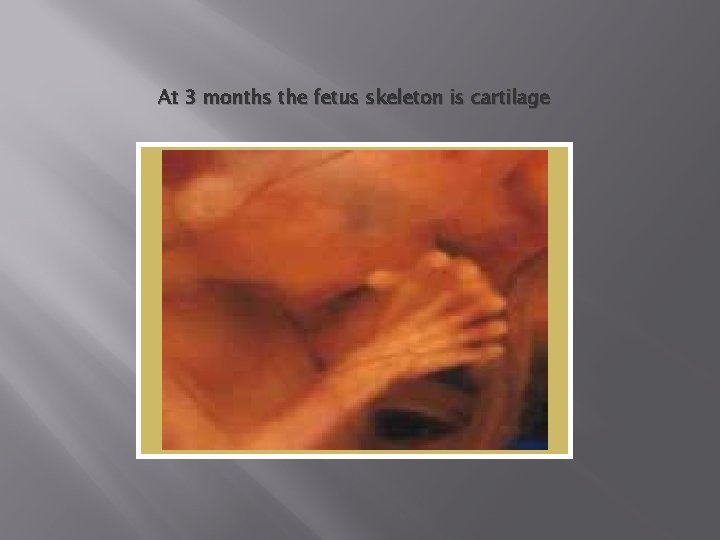 At 3 months the fetus skeleton is cartilage 