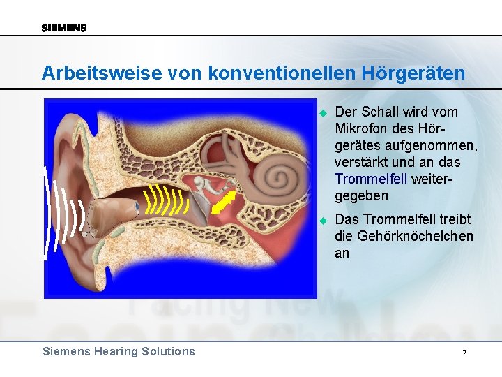 Arbeitsweise von konventionellen Hörgeräten Siemens Hearing Solutions u Der Schall wird vom Mikrofon des