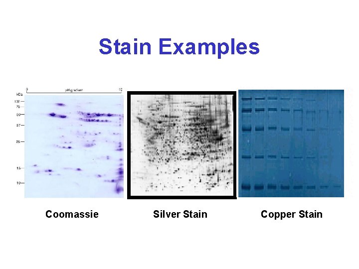 Stain Examples Coomassie Silver Stain Copper Stain 