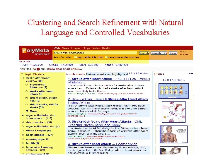 Clustering and Search Refinement with Natural Language and Controlled Vocabularies 