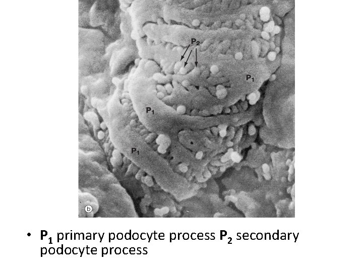 • P 1 primary podocyte process P 2 secondary podocyte process • P 1 primary podocyte process P 2 secondary podocyte process