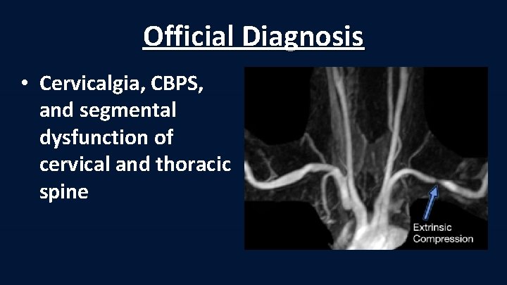 Official Diagnosis • Cervicalgia, CBPS, and segmental dysfunction of cervical and thoracic spine 