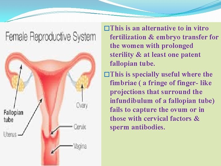 �This is an alternative to in vitro fertilization & embryo transfer for the women