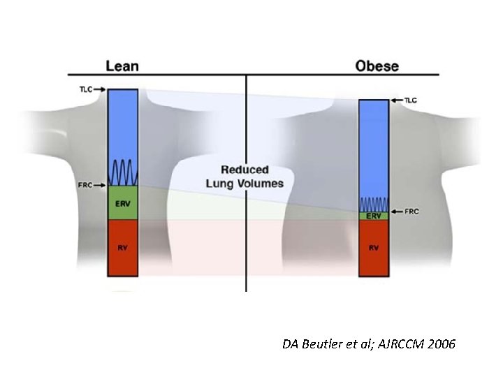 DA Beutler et al; AJRCCM 2006 