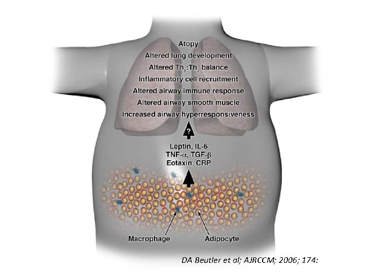 DA Beutler et al; AJRCCM; 2006; 174: 112 