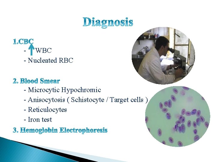  - WBC - Nucleated RBC - Microcytic Hypochromic - Anisocytosis ( Schistocyte /