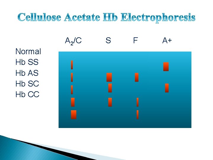 A 2/C Normal Hb SS Hb AS Hb SC Hb CC S F A+