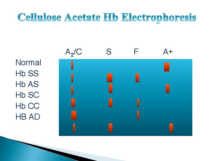 A 2/C Normal Hb SS Hb AS Hb SC Hb CC HB AD S
