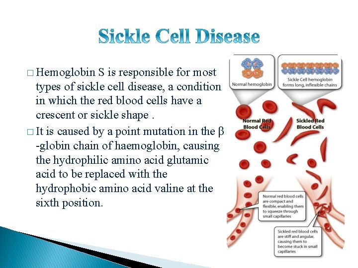 � Hemoglobin S is responsible for most types of sickle cell disease, a condition