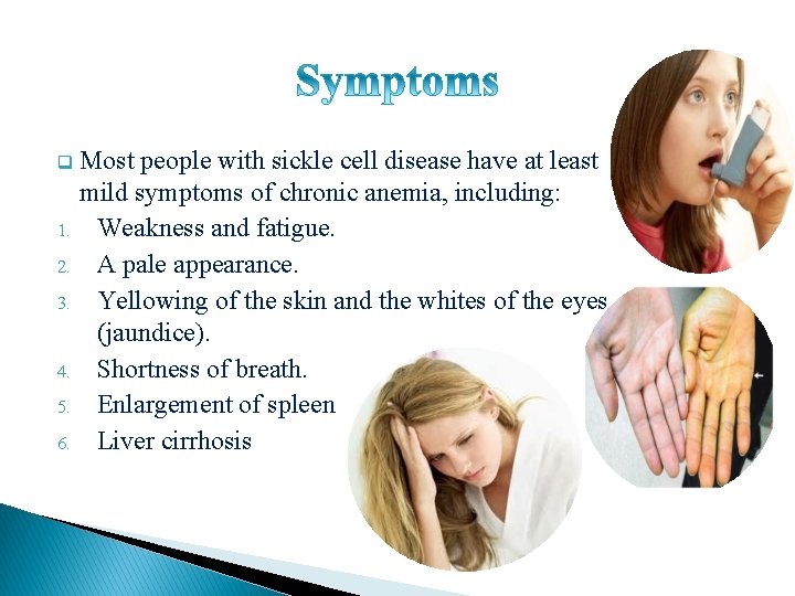 q 1. 2. 3. 4. 5. 6. Most people with sickle cell disease have