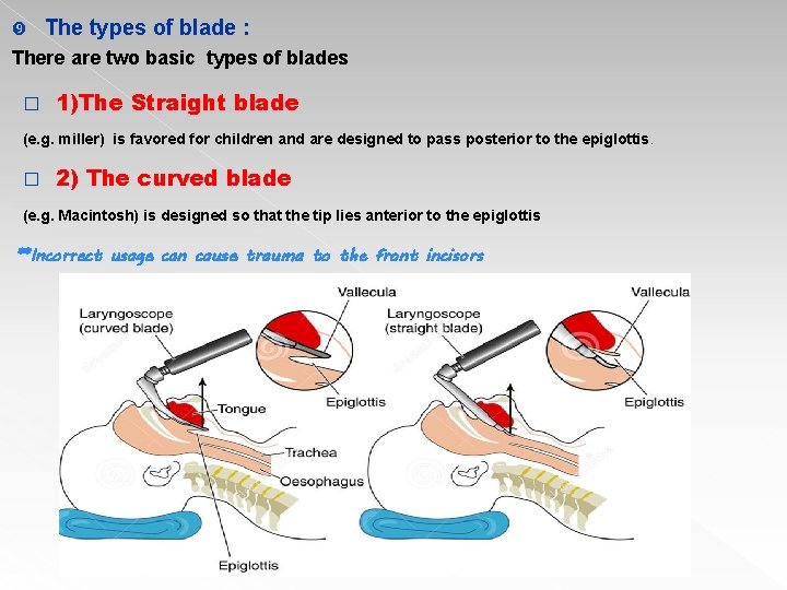  The types of blade : There are two basic types of blades �