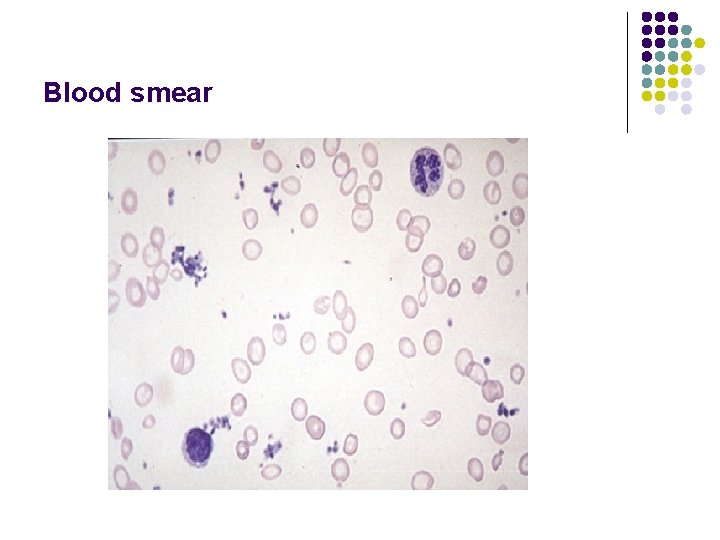 Blood smear 