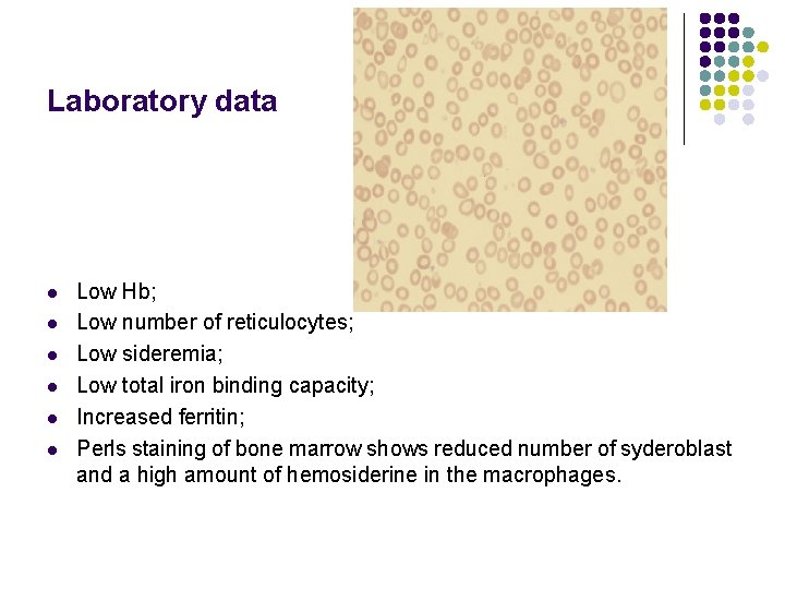 Laboratory data l l l Low Hb; Low number of reticulocytes; Low sideremia; Low
