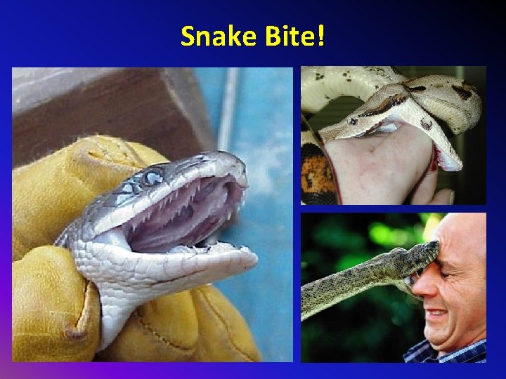 Snake Bite! 