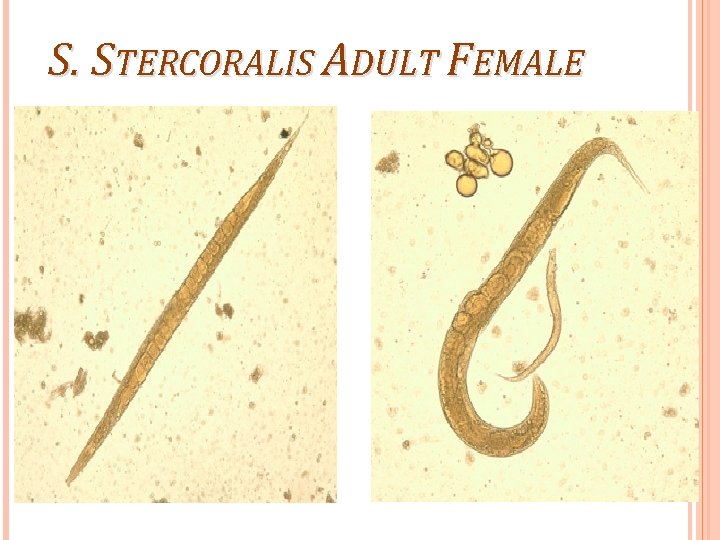 S. STERCORALIS ADULT FEMALE 