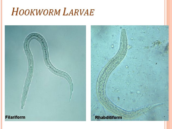 HOOKWORM LARVAE Filariform Rhabditiform 