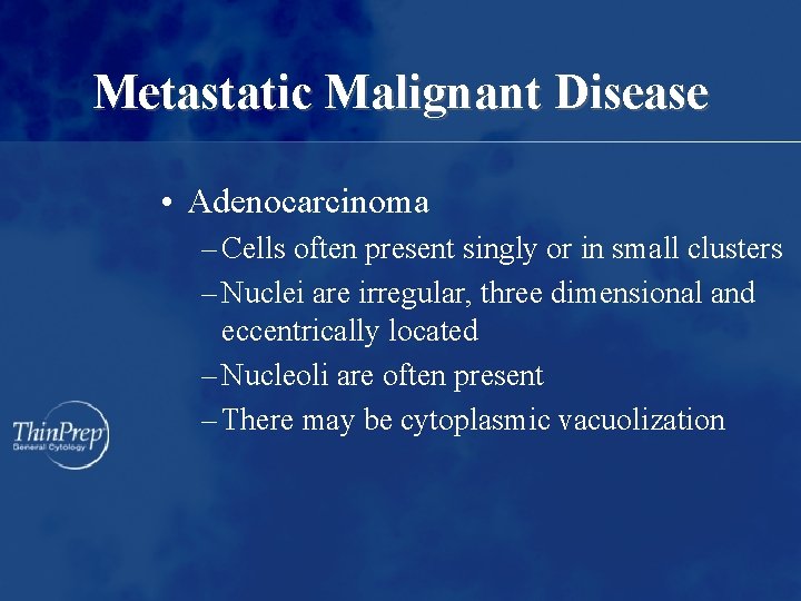 Metastatic Malignant Disease • Adenocarcinoma – Cells often present singly or in small clusters