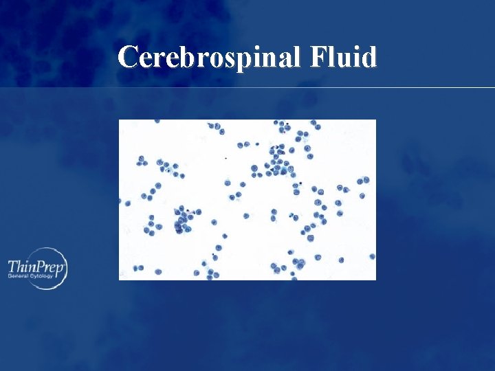 Cerebrospinal Fluid 