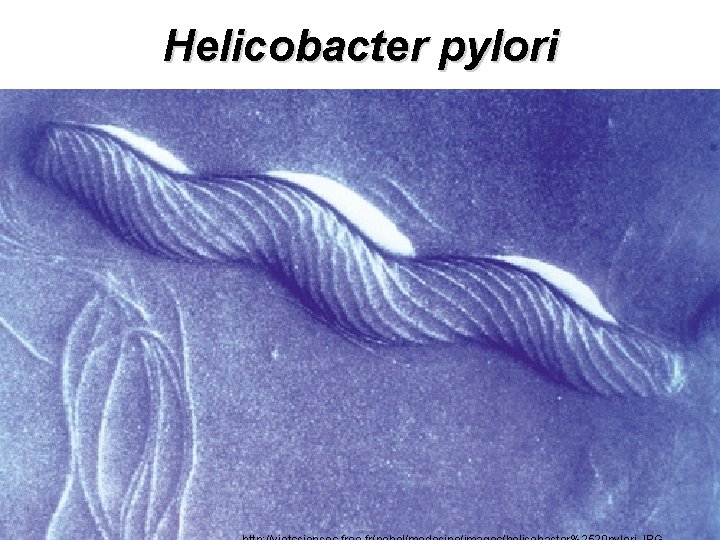 Helicobacter pylori 