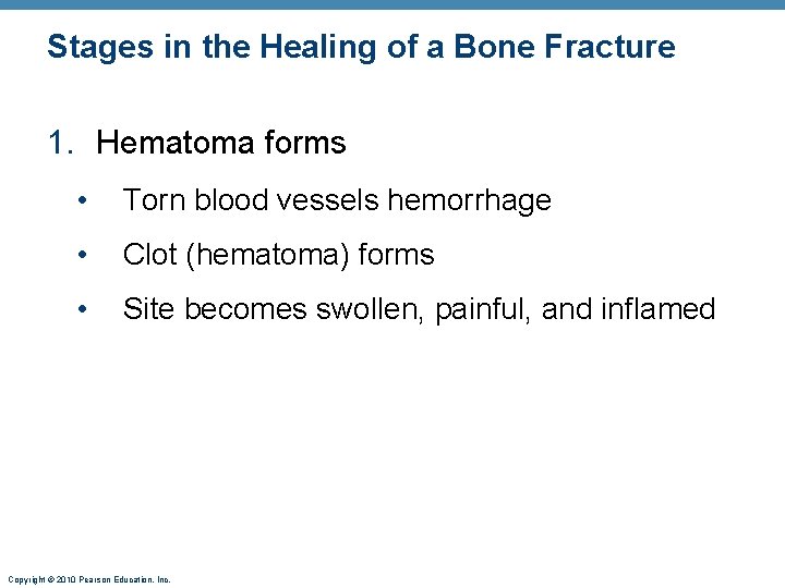 Stages in the Healing of a Bone Fracture 1. Hematoma forms • Torn blood Stages in the Healing of a Bone Fracture 1. Hematoma forms • Torn blood