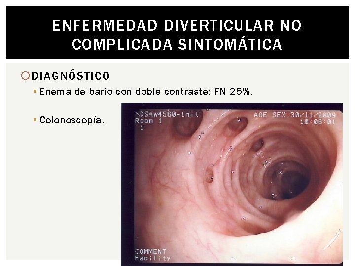 ENFERMEDAD DIVERTICULAR NO COMPLICADA SINTOMÁTICA DIAGNÓSTICO § Enema de bario con doble contraste: FN