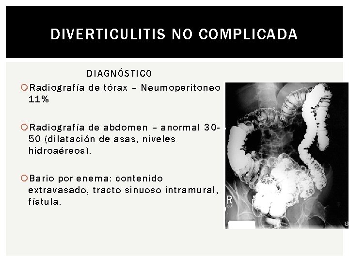 DIVERTICULITIS NO COMPLICADA DIAGNÓSTICO Radiografía de tórax – Neumoperitoneo 11% Radiografía de abdomen –