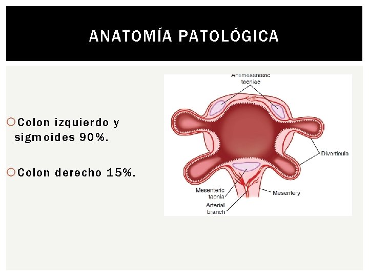 ANATOMÍA PATOLÓGICA Colon izquierdo y sigmoides 90%. Colon derecho 15%. 