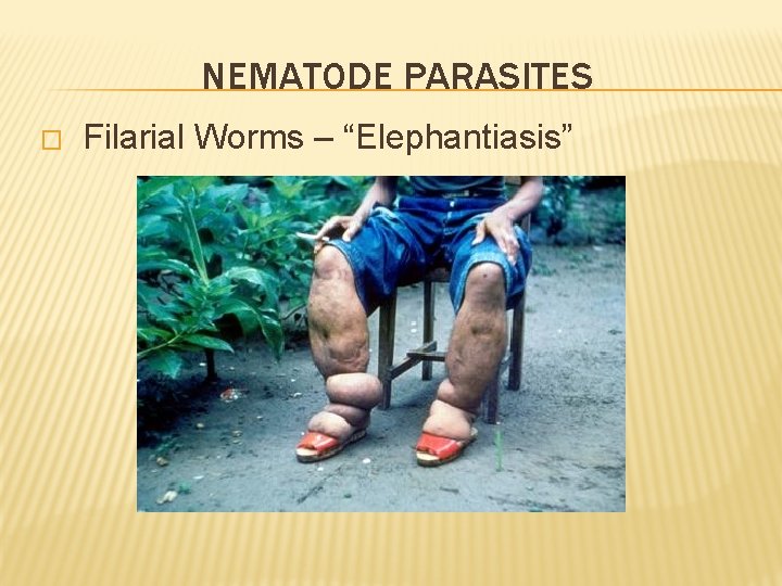 NEMATODE PARASITES � Filarial Worms – “Elephantiasis” 