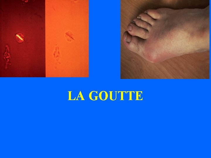 LA GOUTTE 