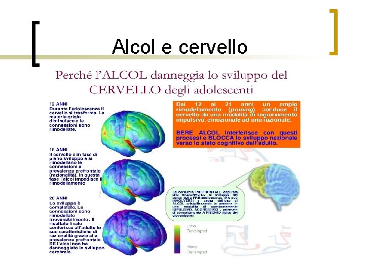 Alcol e cervello 