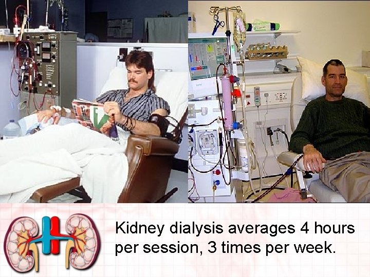 Kidney dialysis averages 4 hours per session, 3 times per week. 