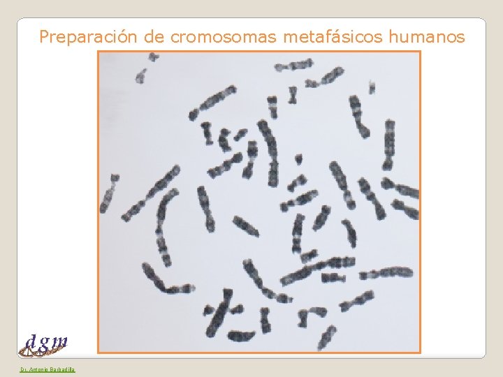 Preparación de cromosomas metafásicos humanos Dr. Antonio Barbadilla 