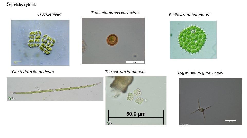 Čepelský rybník Crucigeniella Closterium limneticum Trachelomonas volvocina Tetrastrum komarekii Pediastrum boryanum Lagerheimia genevensis 