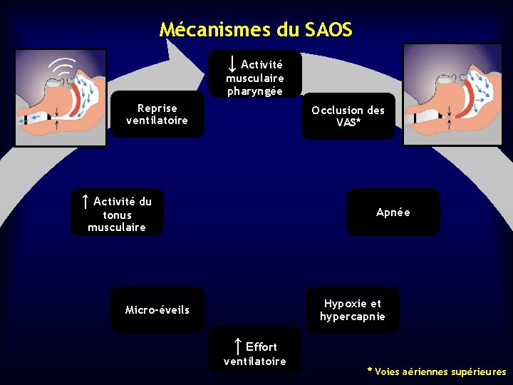 Mécanismes du SAOS ↓ Activité musculaire pharyngée Reprise ventilatoire Occlusion des VAS* ↑ Activité