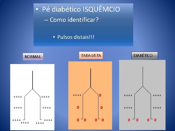  • Pé diabético ISQUÊMCIO – Como identificar? • Pulsos distais!!! TABAGISTA NORMAL ++++